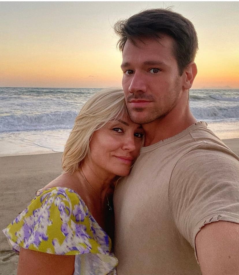 Instagram, izgled Goce Tržan, fleke nakon sunčanja