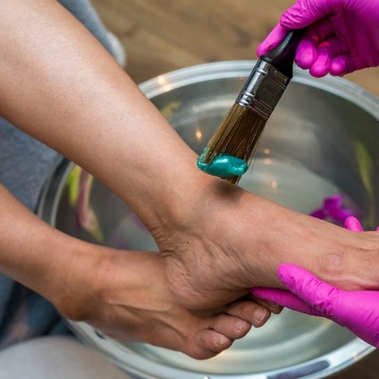 gljivice na stopalima