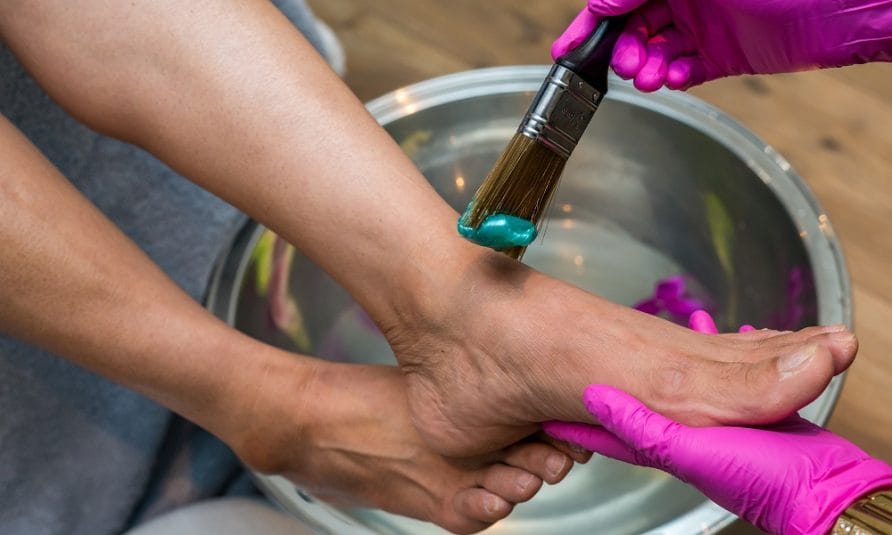 gljivice na stopalima