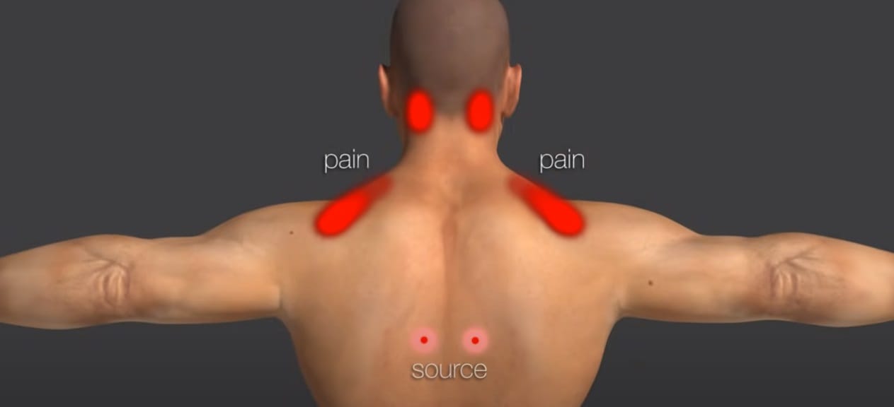 Printscreenyoutube, bolni čvorići u vratu i lopaticama