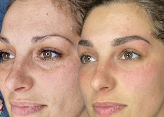 microblanding i senčenje obrva