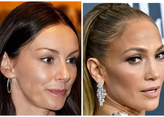 Kačket Slobode Mićalović i Dženifer Lopez