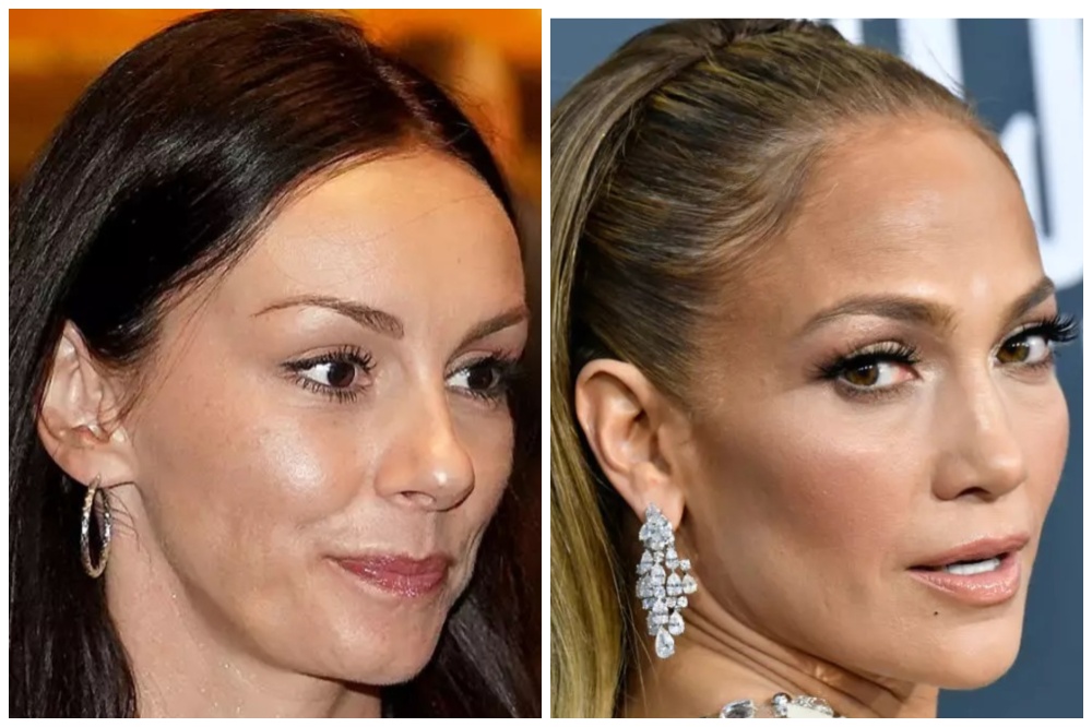 Kačket Slobode Mićalović i Dženifer Lopez