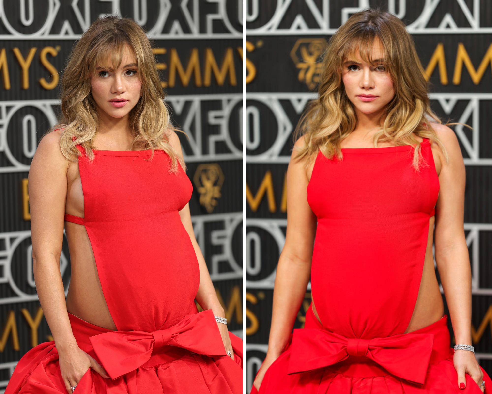 Suki Voterhaus posle porođaja