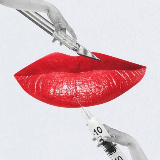 Ultimativni vodič za botoks lica