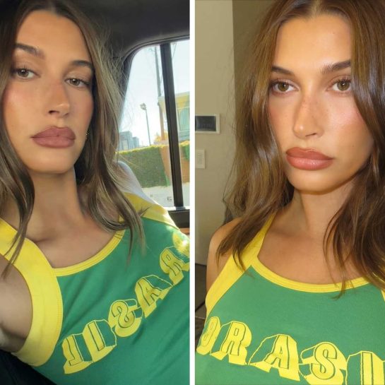 Kozmetički tretmani za lice koje radi Hailey Bieber